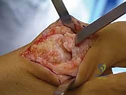 التخدير والتعقيم قبل الجراحة