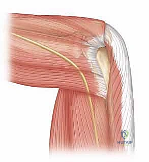 صورة توضيحية لـ منظار مفصل الكوع: دليل شامل للمرضى والعلاج مع الأستاذ الدكتور محمد هطيف في صنعاء