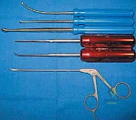 صورة توضيحية لـ منظار مفصل الكوع: دليل شامل للمرضى والعلاج مع الأستاذ الدكتور محمد هطيف في صنعاء