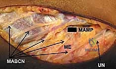 وضعية المريض في غرفة العمليات