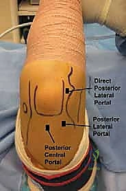 صورة توضيحية لـ منظار مفصل الكوع: دليل شامل للمرضى والعلاج مع الأستاذ الدكتور محمد هطيف في صنعاء