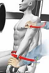 صورة توضيحية لـ تثبيت كسور عظم العضد القريب بالمسامير النخاعية: دليل شامل للمرضى مع الأستاذ الدكتور محمد هطيف