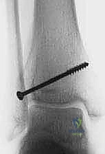 التحضير للعملية الجراحية