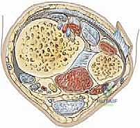 صورة طبية: كسور كاحل الأطفال: دليلك الشامل للعلاج الجراحي المتقن في صنعاء مع الأستاذ الدكتور محمد هطيف