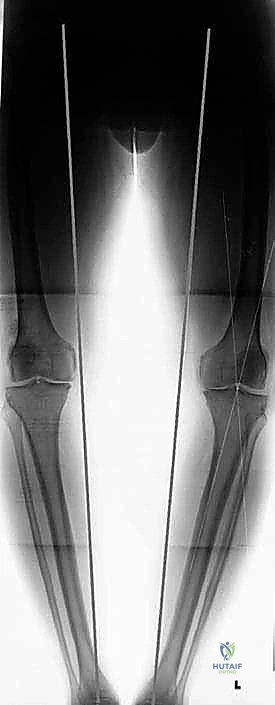 مقارنة بين خيارات العلاج