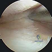 تشريح الركبة ومحور التحميل