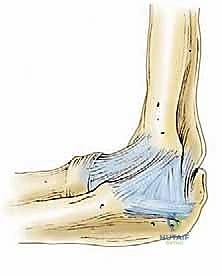 تنظير مفصل المرفق لعلاج التهاب العظم والغضروف السالخ وإصابات الغضروف: دليل شامل للمرضى