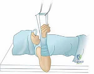 الفحص السريري والتشخيص الدقيق لحالة التهاب العظم والغضروف السالخ