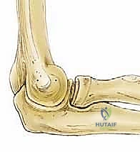 صورة توضيحية لـ تنظير مفصل المرفق لعلاج التهاب العظم والغضروف السالخ وإصابات الغضروف: دليل شامل للمرضى