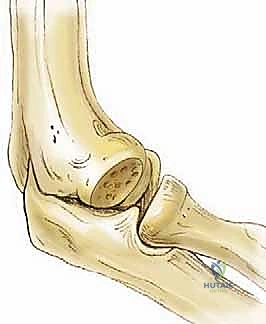تشريح مجمع أربطة المرفق الإنسية والوحشية ودورها في الاستقرار