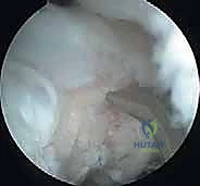 تجهيز غرفة العمليات وأجهزة التنظير المتقدمة 4K في عيادات الدكتور محمد هطيف