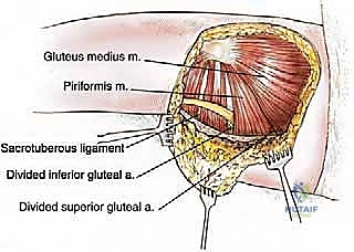 مرحلة التعافي والتأهيل بعد جراحة الأورام