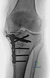 مقارنة الخيارات العلاجية