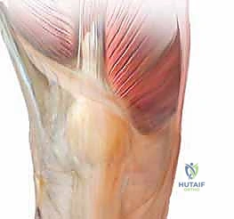 صورة طبية: استبدال مفصل الركبة الكلي بالإسمنت: حل دائم لآلام الركبة المزمنة في صنعاء مع الأستاذ الدكتور محمد هطيف