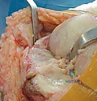 اختبار مدى حركة الركبة