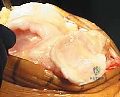 قياس حجم المفصل المناسب