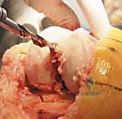 اختبار توازن الأربطة