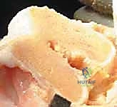 صورة طبية: استبدال مفصل الركبة الكلي بالإسمنت: حل دائم لآلام الركبة المزمنة في صنعاء مع الأستاذ الدكتور محمد هطيف