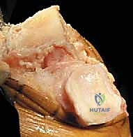 Intraoperative Surgical Step