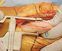 التأكد من استواء السطح