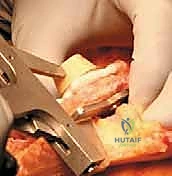 Clinical Image