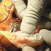 وضع المفصل التجريبي