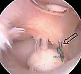 تنظير المرفق المتقدم بتقنية 4K
