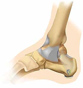 الميكانيكا الحيوية لحركة القدم