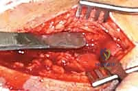 تشريح مفصل الكاحل والميكانيكا الحيوية