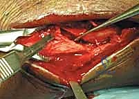 تخطيط الجراحة من قبل الأستاذ الدكتور محمد هطيف