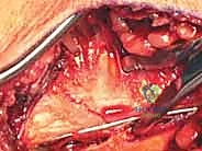 تفاصيل تشريحية للكعبين الإنسي والوحشي