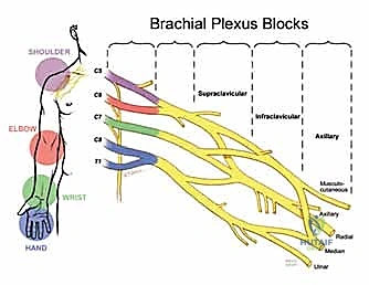 صورة توضيحية لـ التخدير في جراحات الطرف العلوي: دليل شامل للمرضى من الأستاذ الدكتور محمد هطيف
