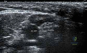 تقييم المريض قبل الجراحة في عيادة الدكتور محمد هطيف