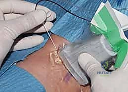 مراقبة العلامات الحيوية أثناء الجراحة