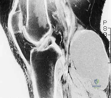 تحليل الأنسجة العظمية تحت المجهر