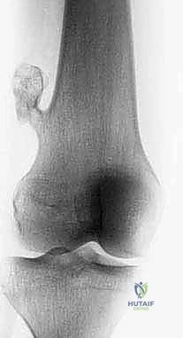 تجهيز المريض والتخدير الموضعي