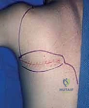 تخطيط العلاج الشامل بعد التشخيص