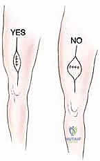 استخدام التقنيات الحديثة في جراحة العظام
