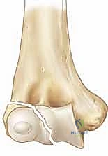 تشريح مفصل الكوع واللقيمة الوحشية