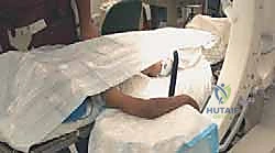 صورة توضيحية لـ كسر اللقيمة الوحشية للعضد عند الأطفال: دليل شامل للآباء والعلاج المتخصص في صنعاء