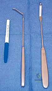 صورة طبية: كسر اللقيمة الوحشية للعضد عند الأطفال: دليل شامل للآباء والعلاج المتخصص في صنعاء