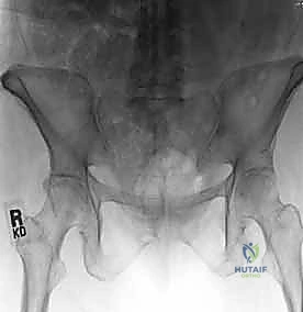 خبرة الدكتور محمد هطيف في الجراحة الدقيقة