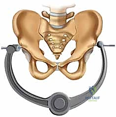 التحضير لعملية تثبيت الحوض المفتوح