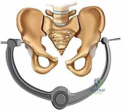 الأستاذ الدكتور محمد هطيف جراحة العظام صنعاء