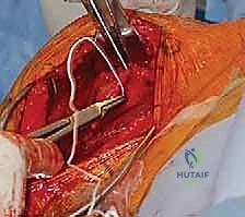 الرعاية الطبية مع الأستاذ الدكتور محمد هطيف