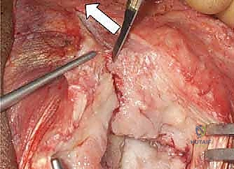 التصوير الطبي للكتف