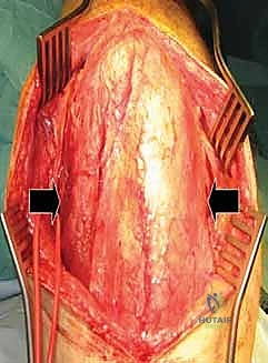 صورة طبية: مناهج جراحة الكتف وعظم العضد: دليل شامل للمرضى مع الأستاذ الدكتور محمد هطيف في صنعاء