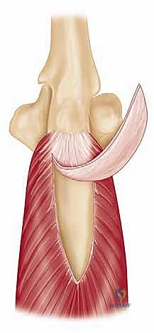 صورة طبية: مناهج جراحة الكتف وعظم العضد: دليل شامل للمرضى مع الأستاذ الدكتور محمد هطيف في صنعاء