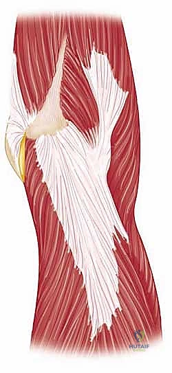 متلازمة الانحشار في الكتف