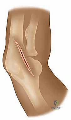 فحص وتقييم أعراض الكتف